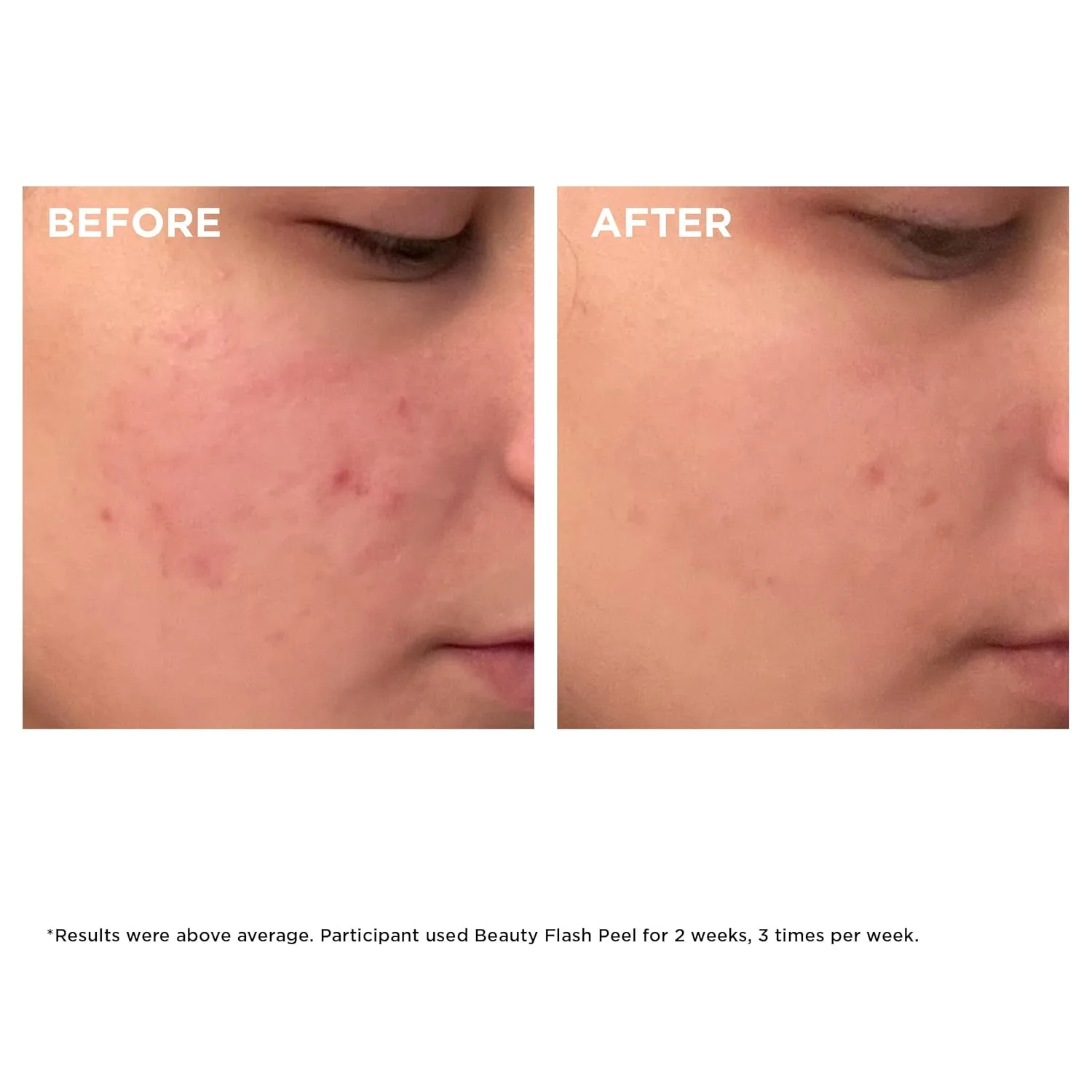 Пилинг Clarins — Beauty Flash Peel: -минутная домашняя процедура для сужения пор, удаления омертвевших, 48.2 г — фото 4