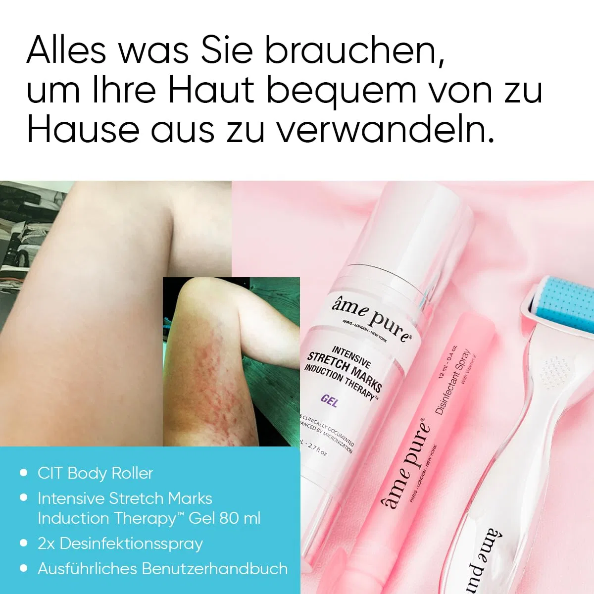 Набор для удаления растяжек AME PURE Body Roller Kit 0.75 мм Âme Pure — фото 3