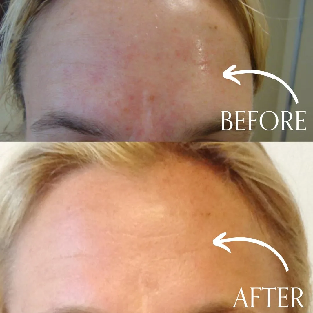Маска для лица Radical Skincare — Age-Defying Exfoliating Pads для удаления омертвевшей кожи, выравнивания и осветления — фото 3