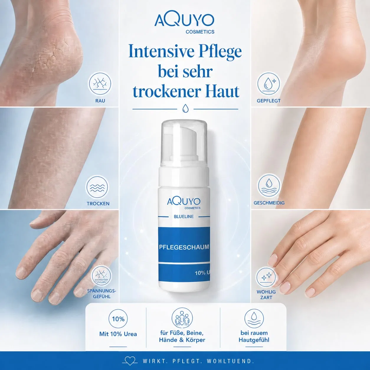 Пенка для тела с 10% мочевины, AQUYO Cosmetics, 100 мл — фото 2