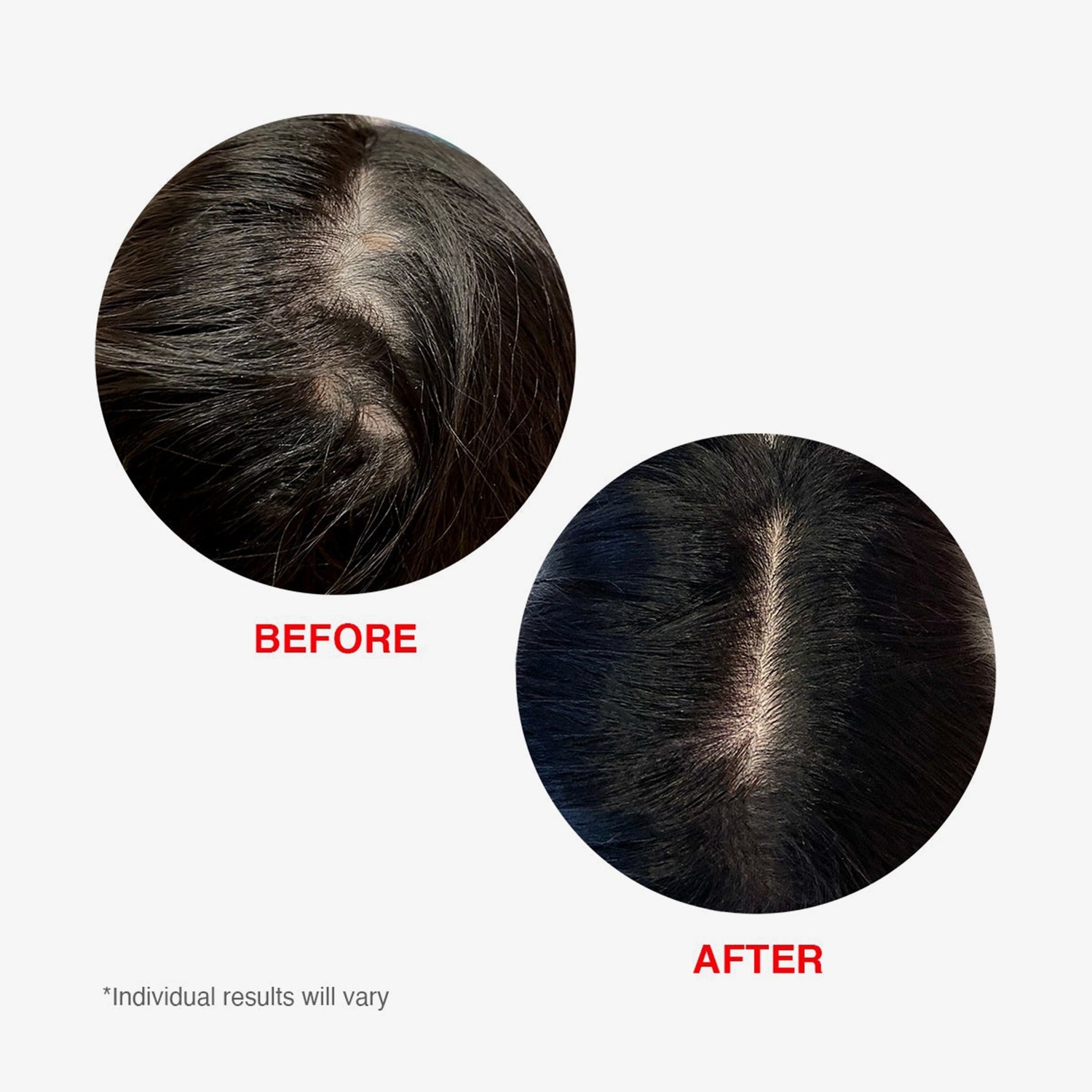 Сыворотка для волос scalp serum Hairtamin, объем 60 мл — фото 4