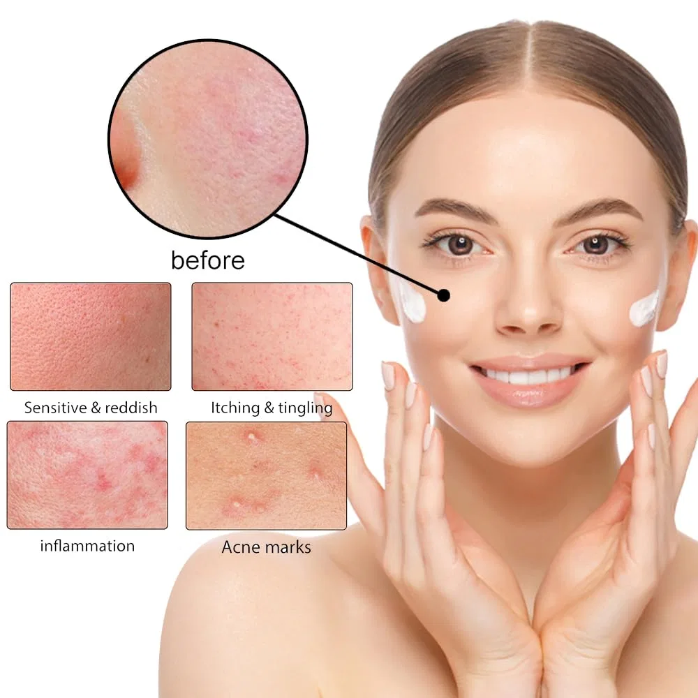 Крем для лица KUIRUNRX — Relief Cream — фото 3