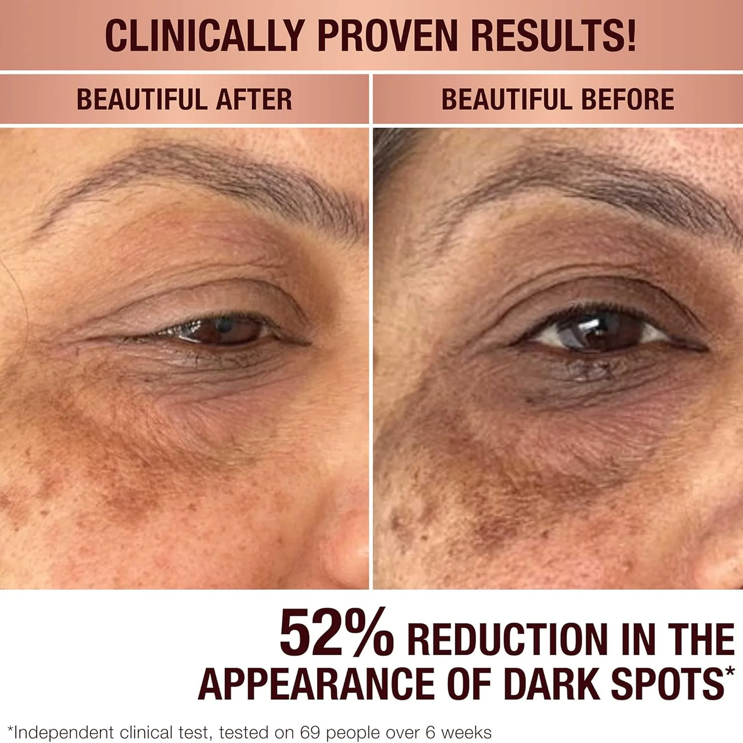 Charlotte Tilbury Radiance Recovery сыворотка от темных пятен с транексамовой кислотой и витамином C для сияния, уменьшения покраснений и неровного тона кожи 28.63 г (1 шт.) — фото 2