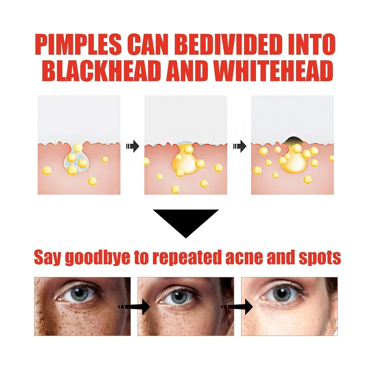 Сыворотка для лица Blemish Solution, 30 мл Generisch — фото 3