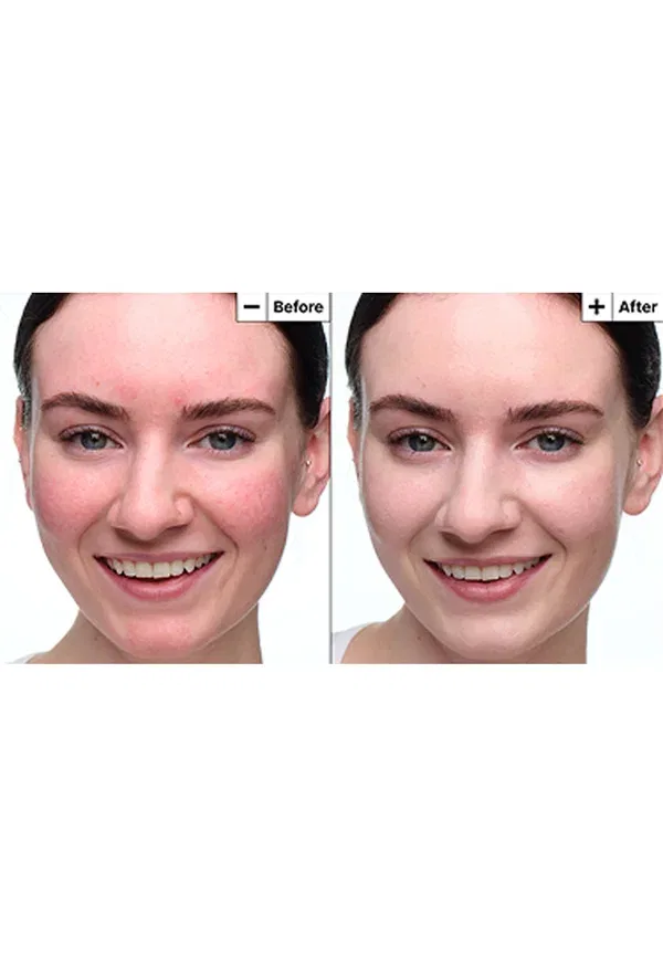 Успокаивающие капли Cicapair с SPF 20 - сыворотка 30 мл Dr. Jart+ — фото 4
