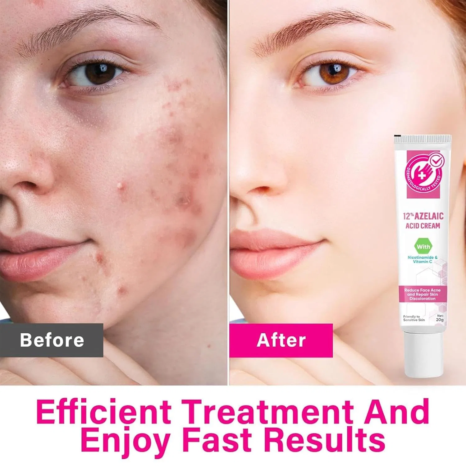 Сыворотка для лица 12% Niacinamide + Vitamin C, Generisch, 20 г — фото 3