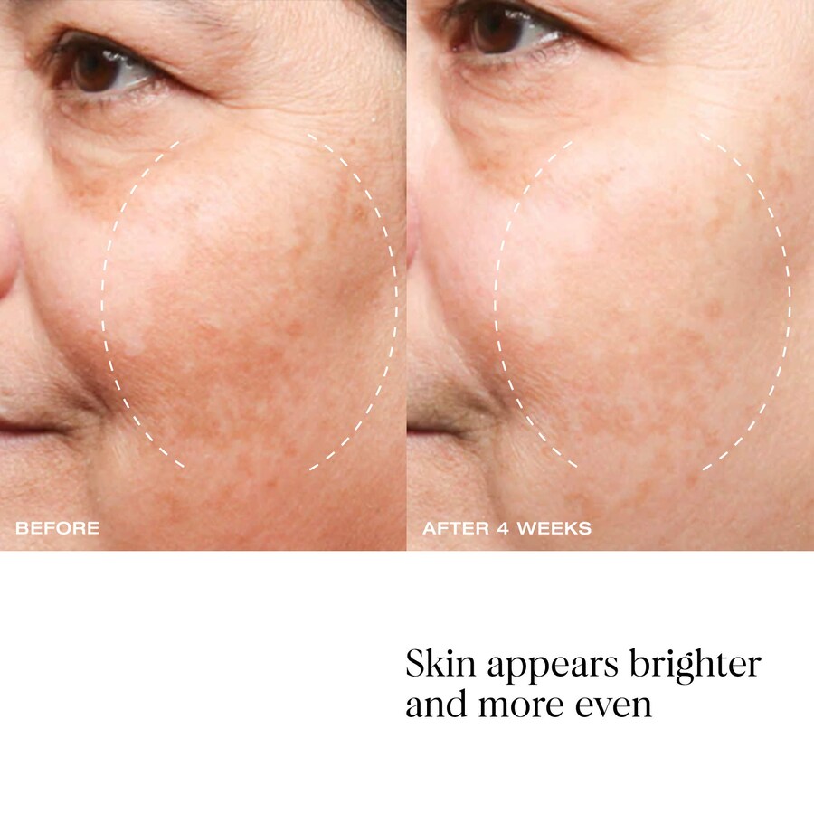 Сыворотка YSE Beauty — Для коррекции пигментных пятен и изменения цвета кожи The Problem Solver All-Over, 50 мл — фото 4