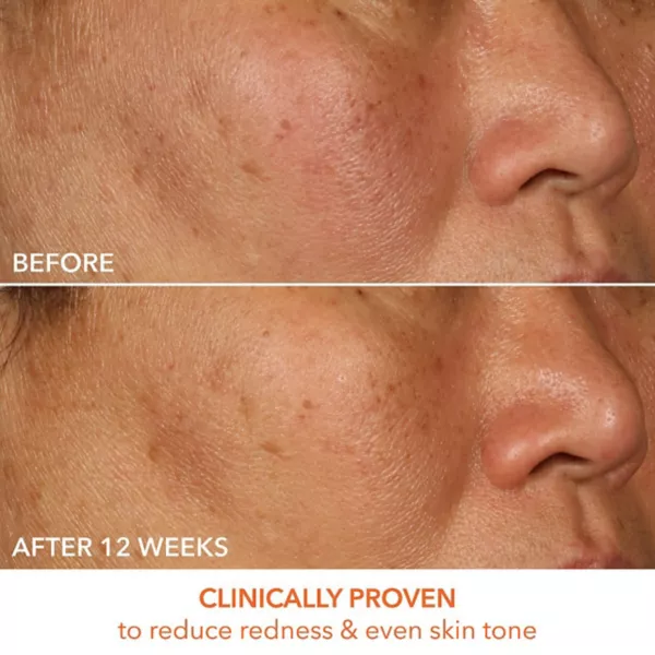 Сыворотка Dr. Dennis Gross Skincare — Витамин С молочный % для упругости и яркости — фото 2
