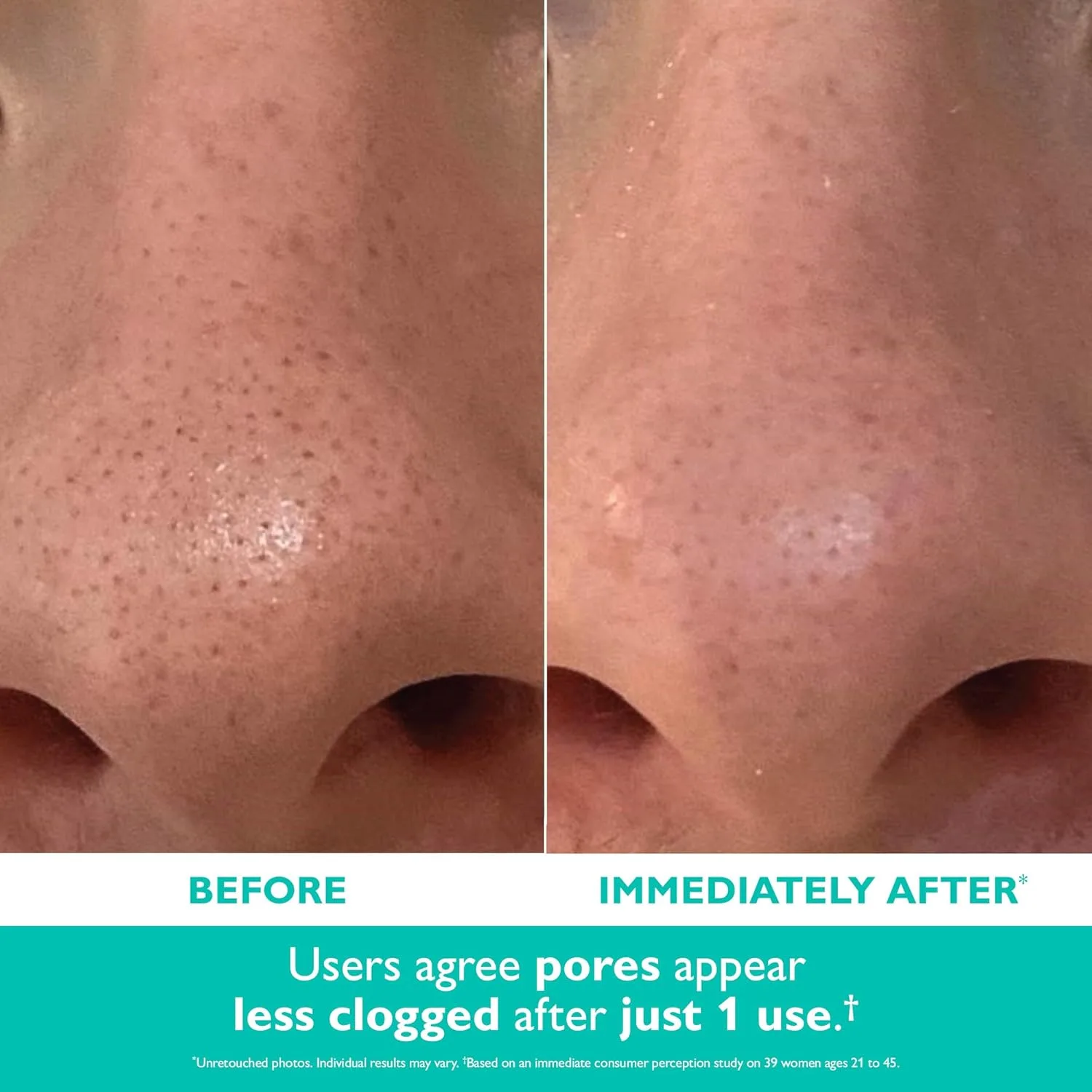 Крем для лица Peter Thomas Roth — | Even Smoother Микродермабразионный отшелушивающий очиститель пор с салициловой кислотой, 50 мл — фото 4