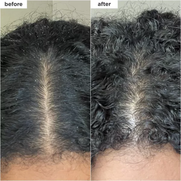 Шампунь-Скраб для кожи головы Scalp Revival с микроотшелушивающим углем и кокосовым маслом Briogeo, объем 227 мл — фото 2
