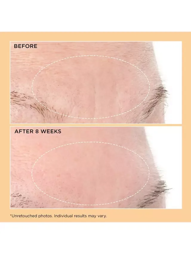 Сыворотка для разглаживания морщин Neuropeptide Deep Crease Serum, 30 мл Perricone MD — фото 4