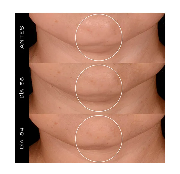 Крем для лица Lancôme — Высокоэффективный антивозрастной Rénergie H.P.N. -Peptide Cream — фото 3