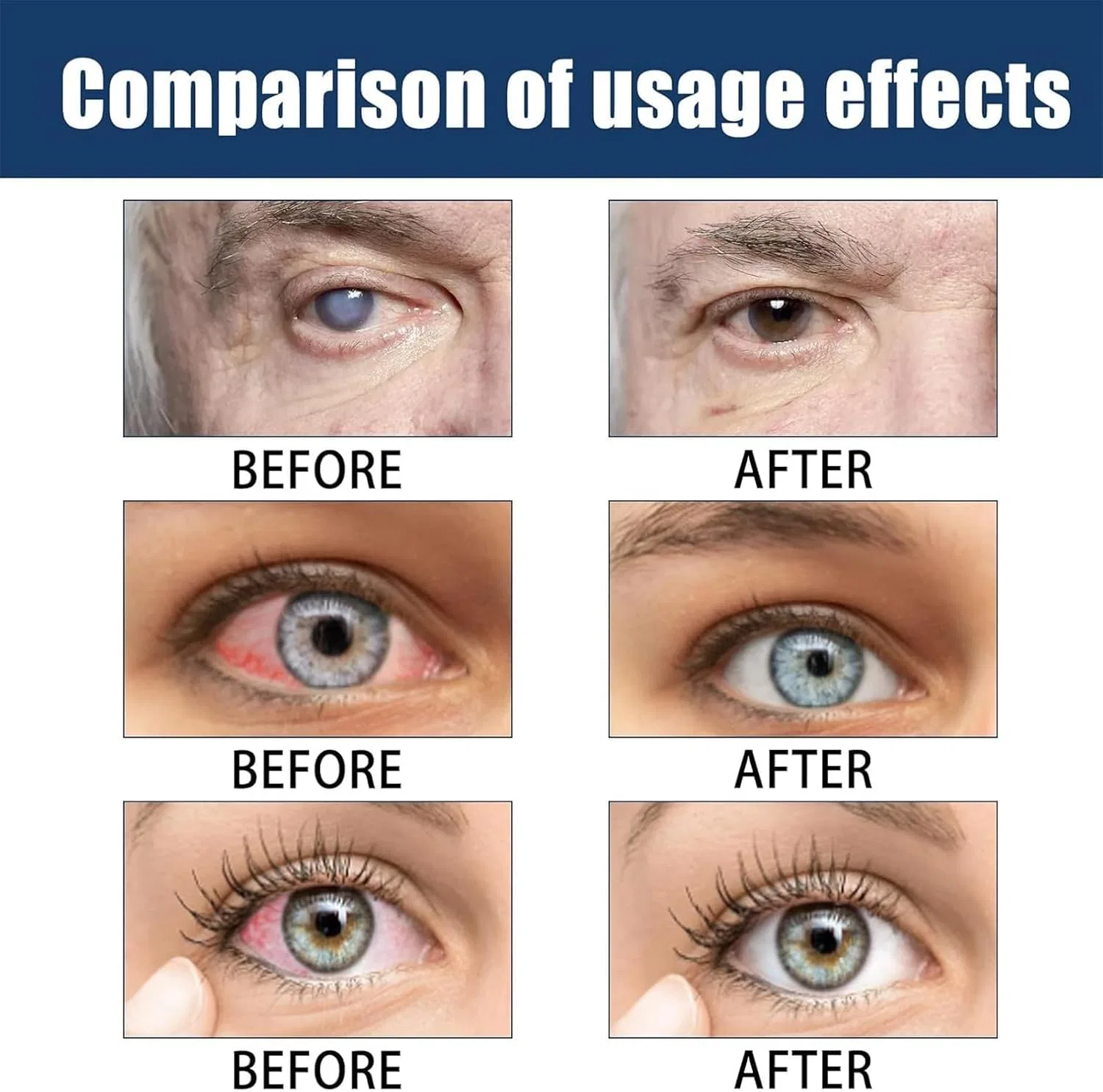 Капли для глаз Presbyopia Recovery Treatment, Pelinuar, набор 2 шт., 15 мл, Pack of 2 — фото 4