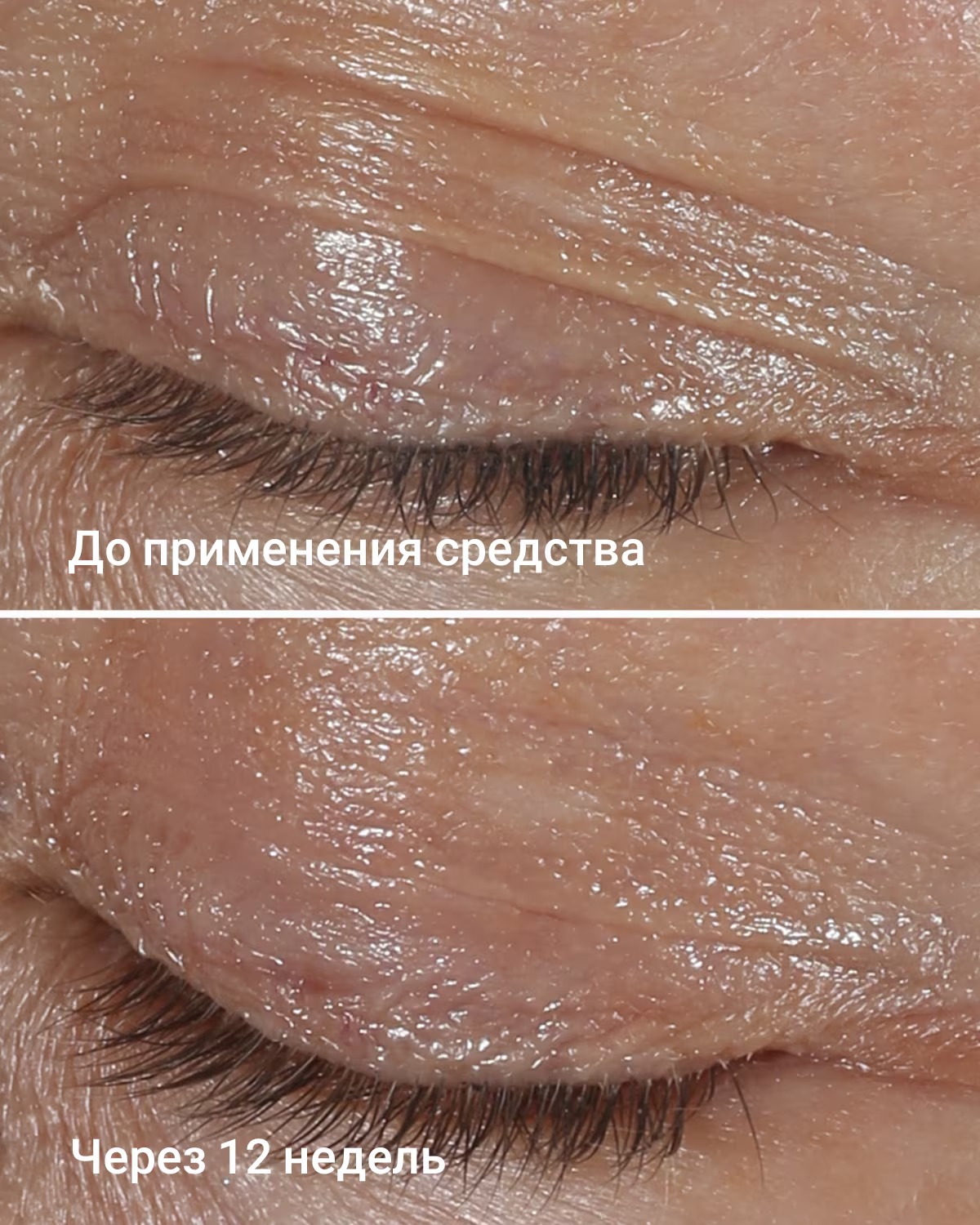 Крем для кожи вокруг глаз Clinique Smart Clinical Repair Wrinkle Correcting — фото 3