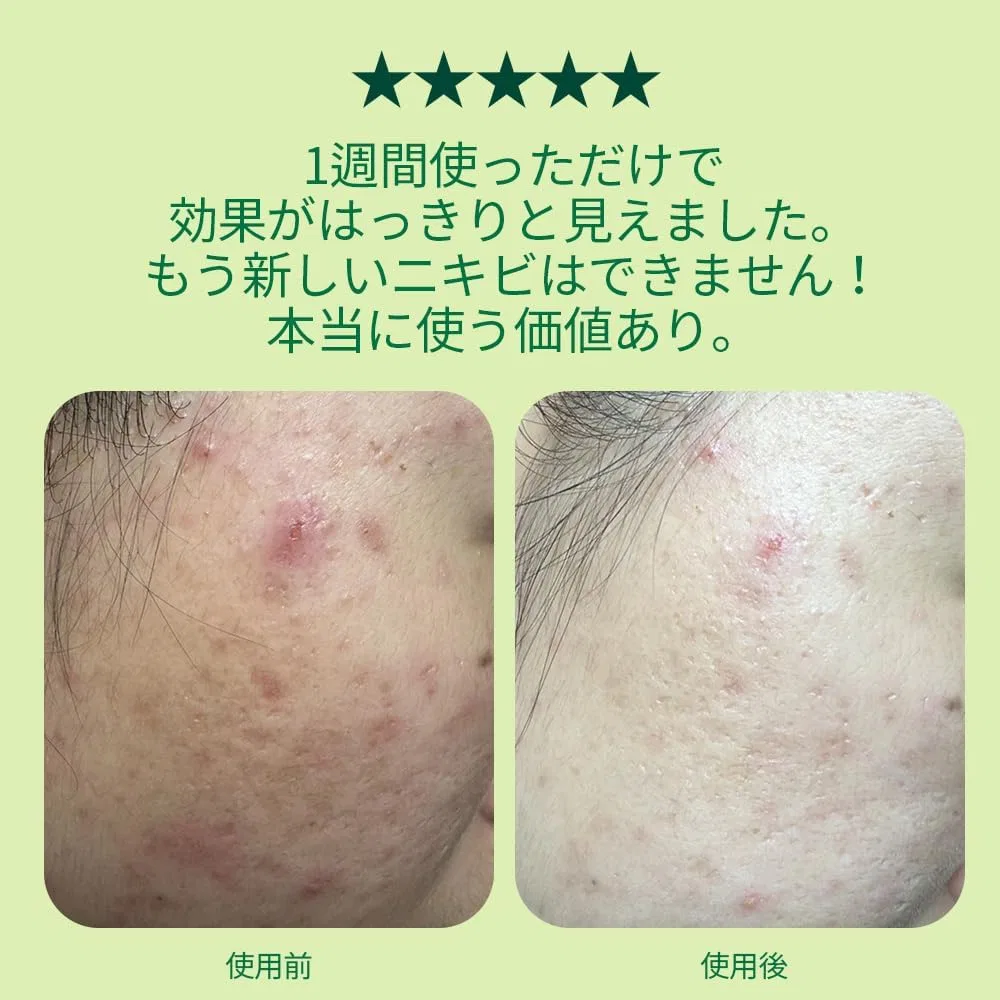 Крем для лица Pyunkang Yul — Дневной успокаивающий Ultimate Calming Solution Cream, 30 мл — фото 3