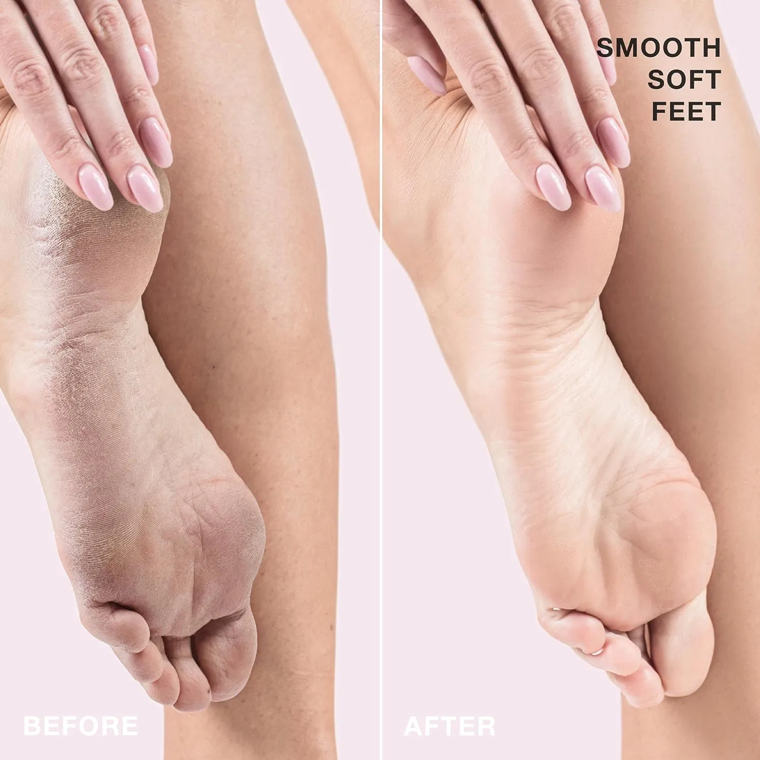 Набор STARSKIN Fab Feet Fast для эксфолиации стоп Starskin — фото 3