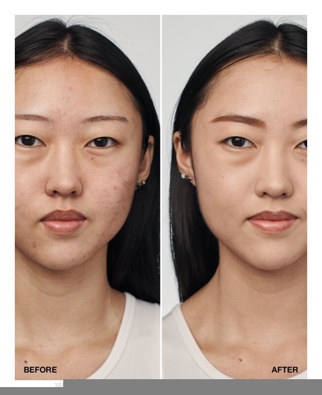 Тональный крем SPF 20 Clinique Even Better Clinical Serum Foundation SPF 20, оттенок CN 28 Ivory 30 мл — фото 3