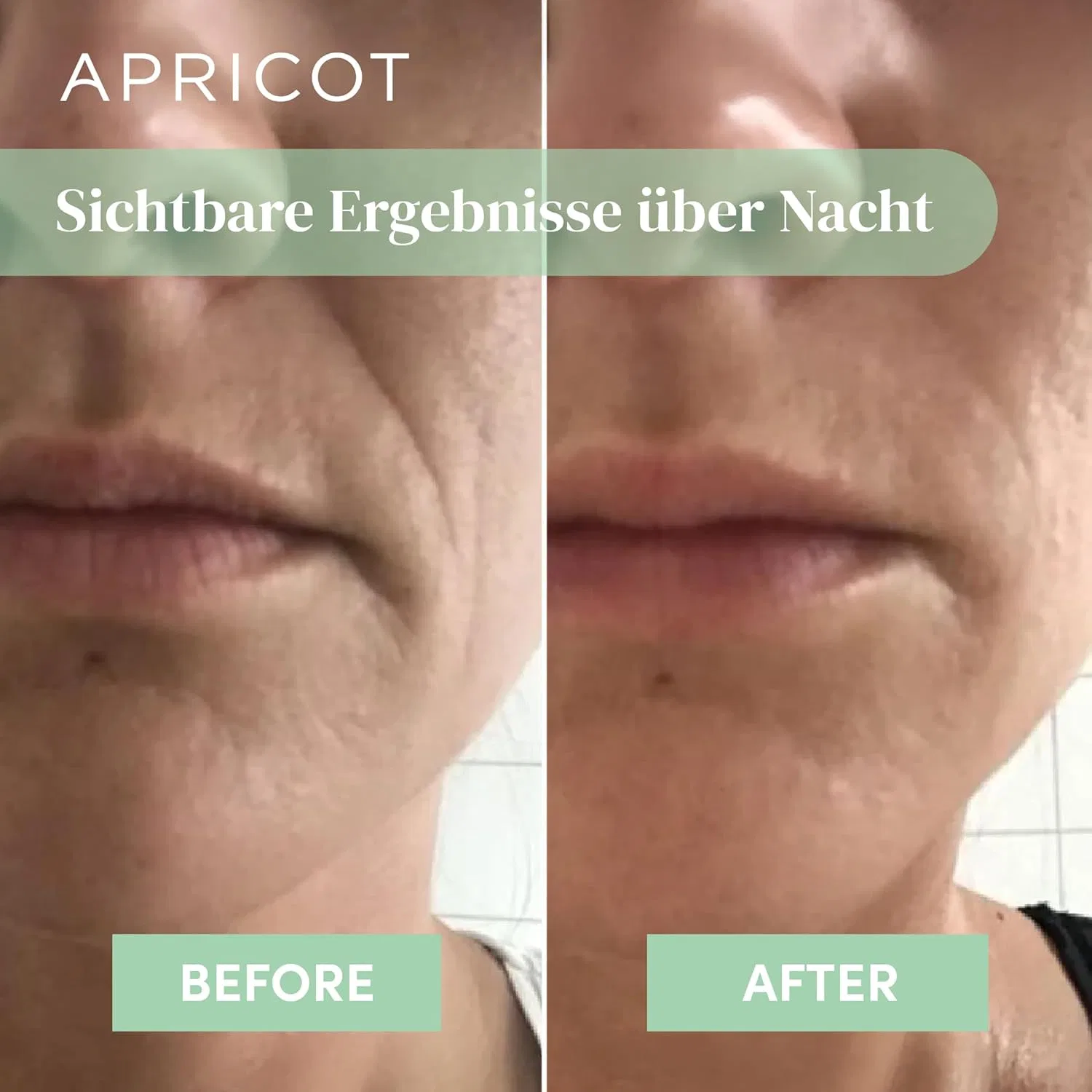 Набор из 60 антивозрастных патчей APRICOT от морщин вокруг рта Apricot Beauty & Healthcare — фото 4