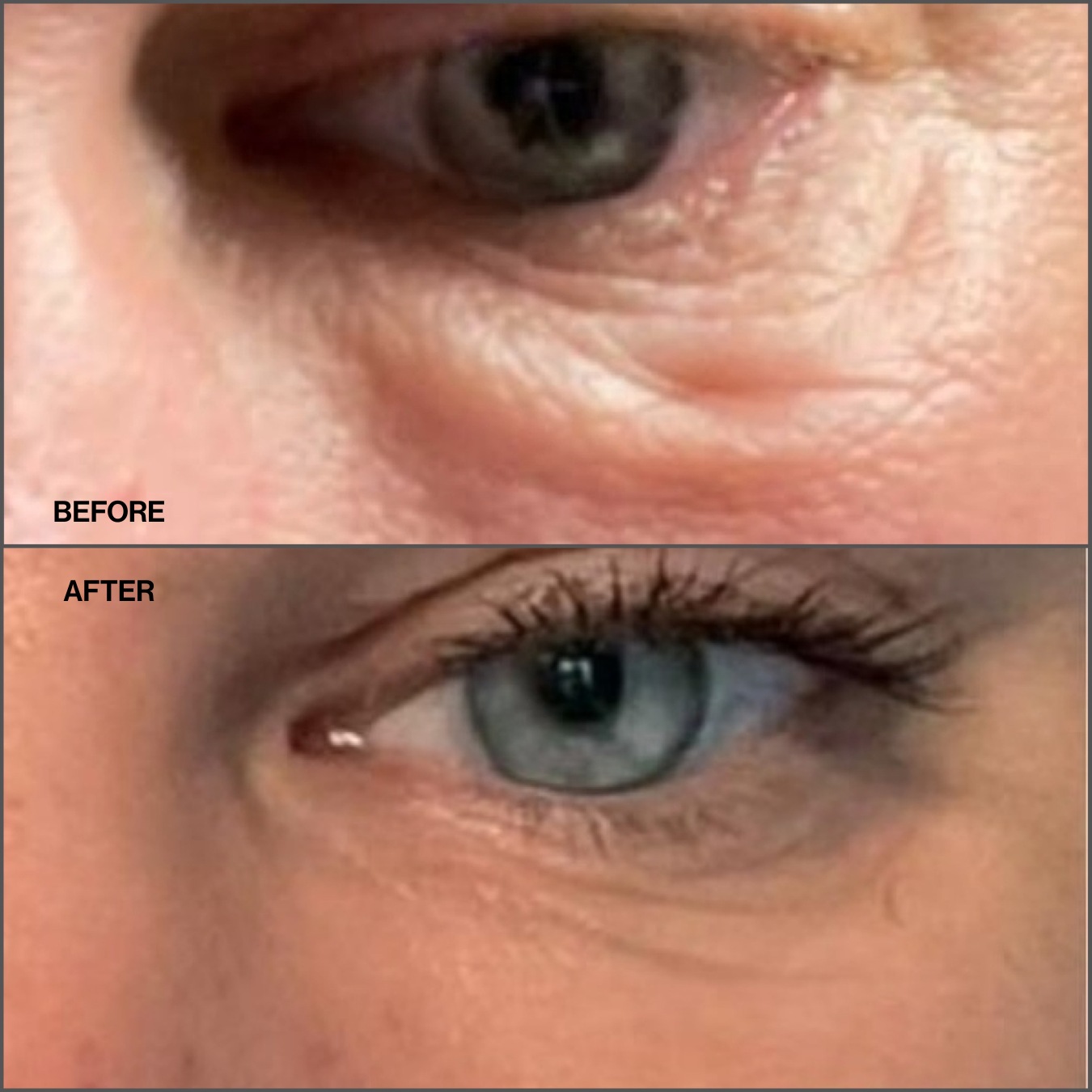 Сыворотка Iraye — Eye revive cream , объем, 30 мл — фото 4