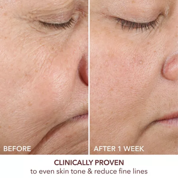 Сыворотка Dr. Dennis Gross Skincare — Улучшенная для обновления текстуры кожи с ретинолом и феруловой кислотой — фото 3