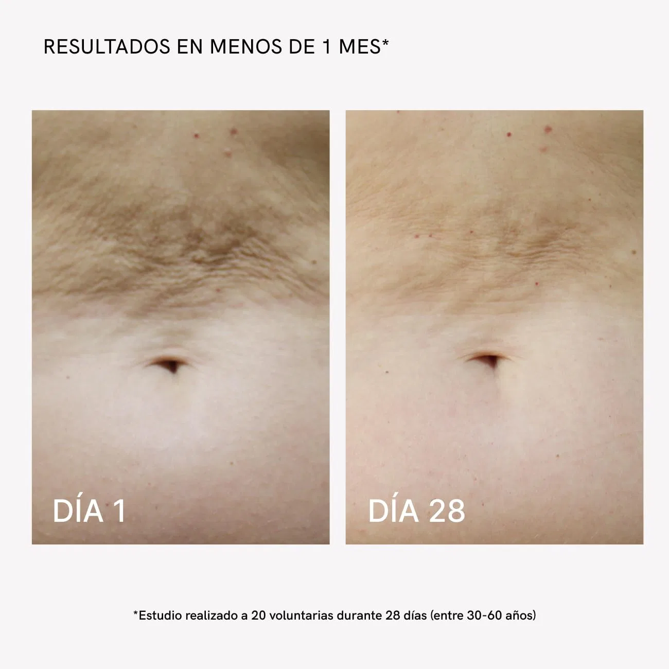 Профессиональный набор для радиочастотного лифтинга MASDERM 2 в 1 Masderm — фото 4