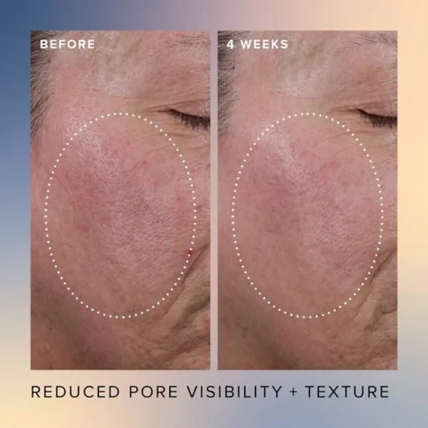 Honey Glow 17% сыворотка с альфа-гидроксикислотами и бета-гидроксикислотами для обновления кожи Farmacy — фото 4