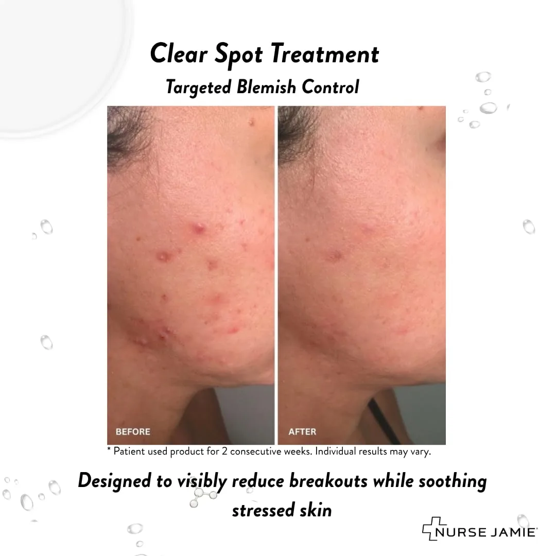 Средство для точечного нанесения Nurse Jamie Clear Spot Treatment - ​​быстродействующее средство для точечного нанесения на ночь, содержащее салициловую кислоту, гликолевую кислоту и серу. — фото 4
