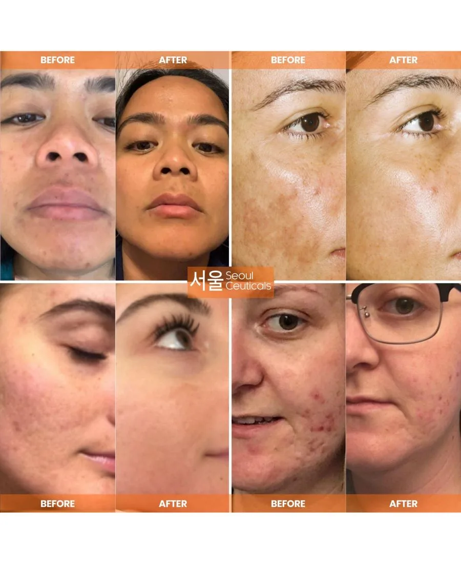 Сыворотка Seoul Ceuticals — Корейская для ухода за кожей с витамином С, дневная для сияния кожи - антивозрастная — фото 3