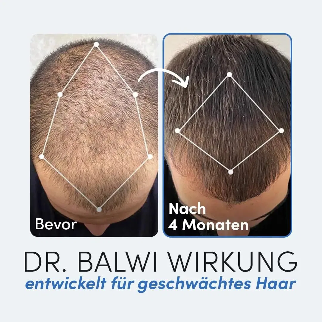 Премиальное масло для волос «100% Premium Hair Oil» от Dr. Balwi Elithair — фото 4