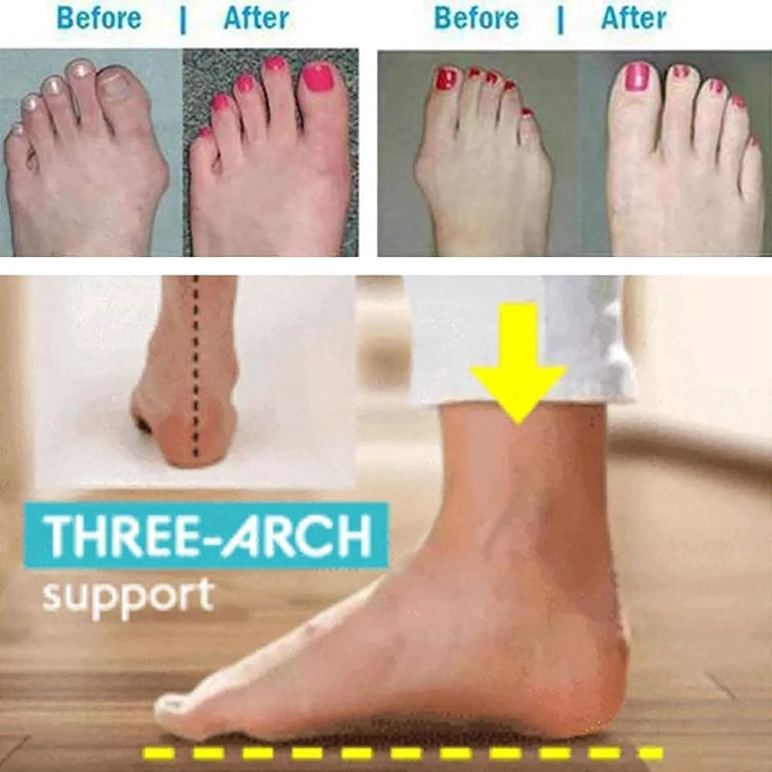 Mens Slippers with Orthopedic Bunion Corrector,Roman Ring Toe Non-Slip Hallux Valgus Flip Flops,Comfy Arch Support Сандалии WCXTY, белый — фото 3