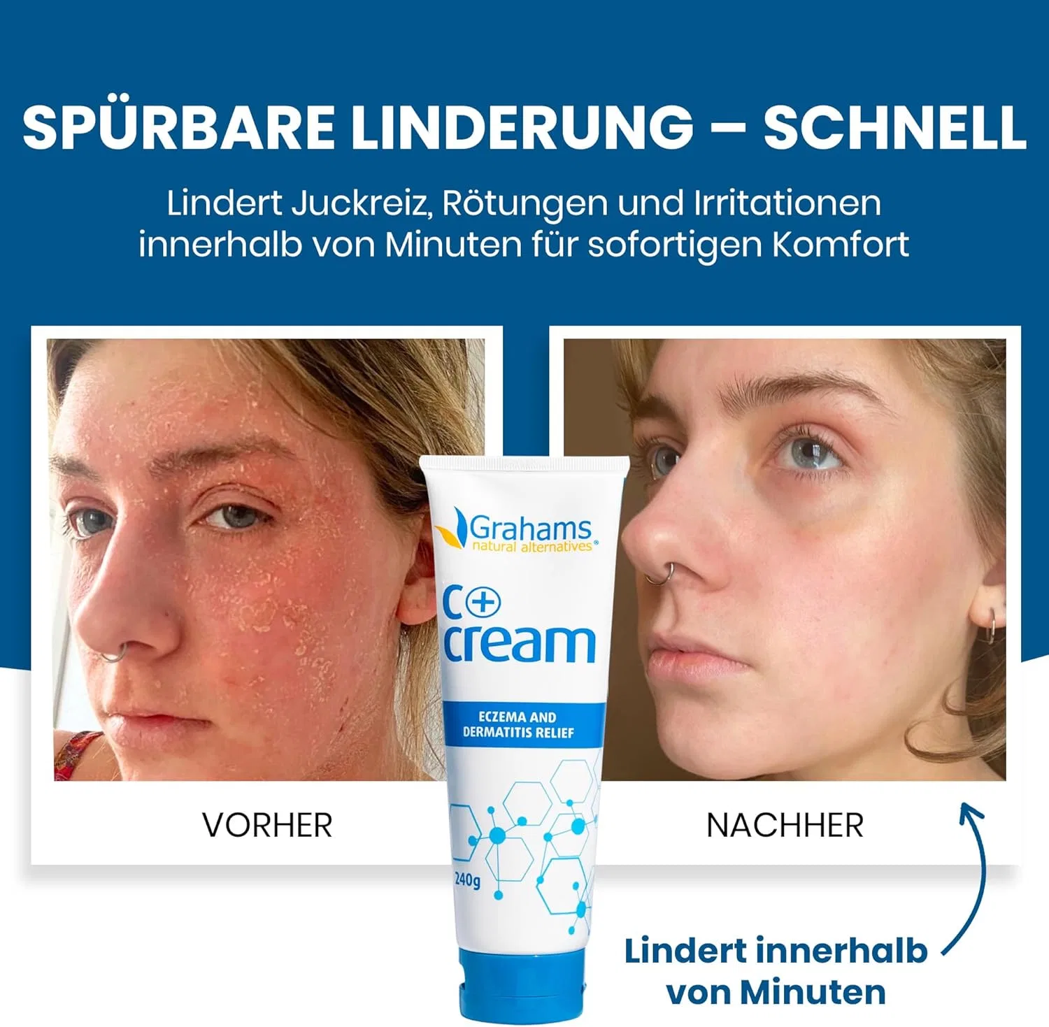 Крем Calendulis Plus для сухой кожи, склонной к экземе, 240 г Grahams Natural — фото 2