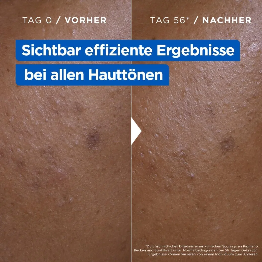 Увлажняющий крем против пигментных пятен «Niacinamide Bright» от Mixa Mixa — фото 4