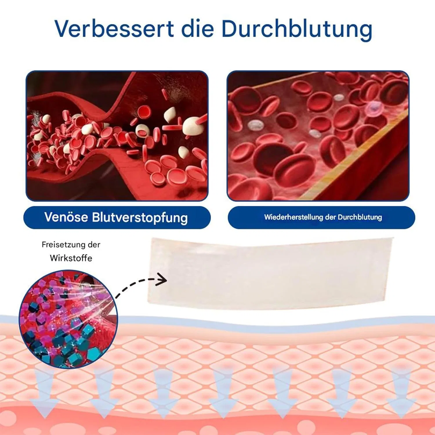 Микроигольный пластырь GFOUK Venous Relaxant для терапии вен ‎Hjjh, 2 — фото 4