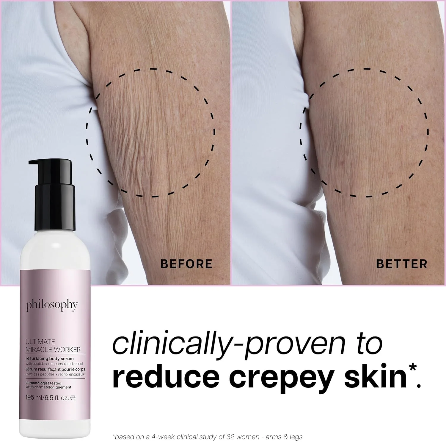Сыворотка Philosophy — Ultimate miracle worker resurfacing body serum с ретинолом, гиалуроновой кислотой и, 192 мл — фото 3