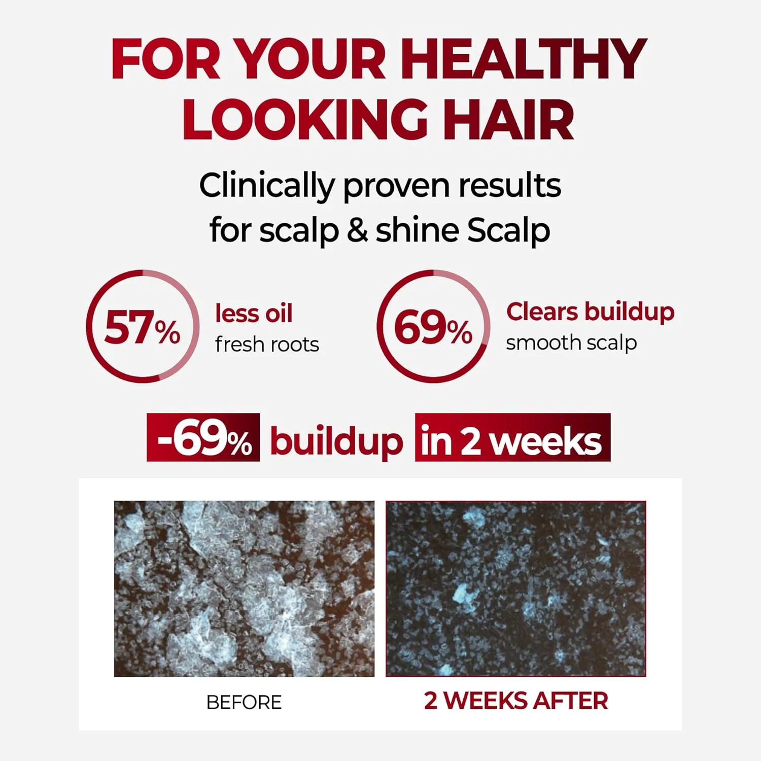 Шампунь CUNDAL CAFFEE ANTIHAIR LOSS для кожи головы Kundal — фото 2