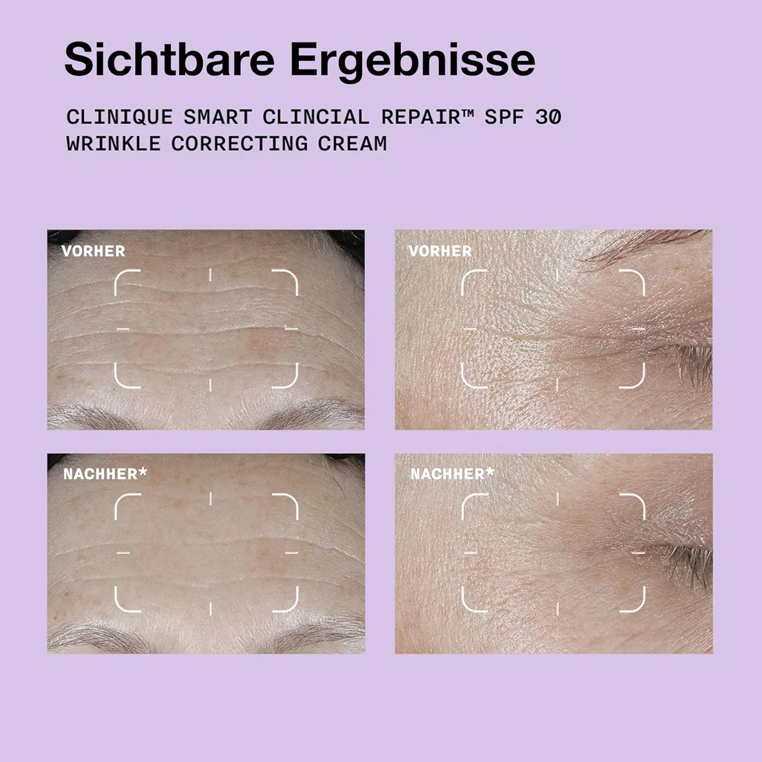 Крем для лица «Smart Clinical Repair SPF 30 Wrinkle Correcting Cream» от Clinique Clinique — фото 4