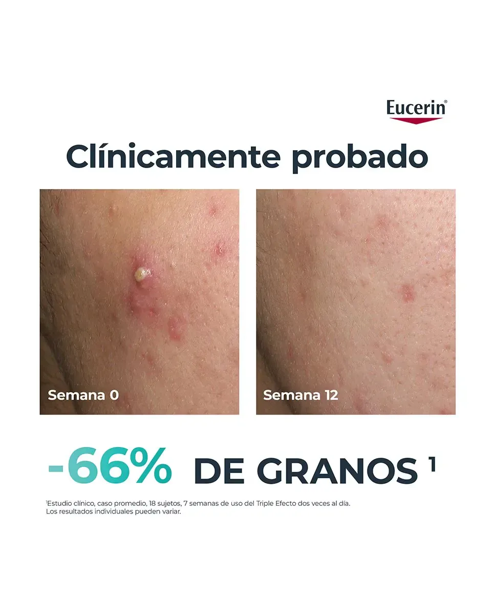 Сыворотка Eucerin — Тройного Действия DermoPure Контроль Жира, 40 мл — фото 3