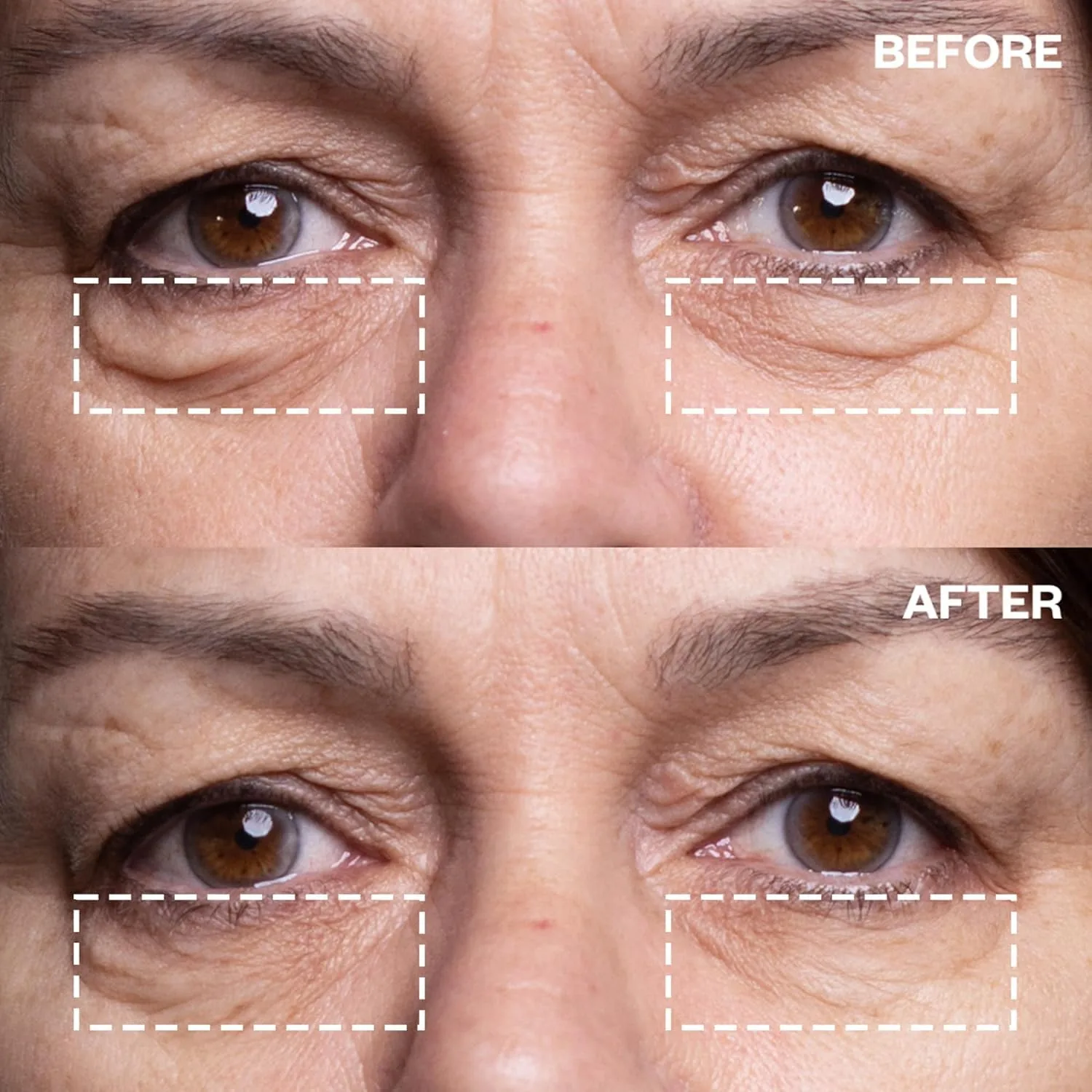 Wrinkles Schminkles стартовый набор от морщин под глазами - 3 пары многоразовых патчей + очиститель для силиконовых патчей 60 мл 3 пары + 56.70 г очищающего средства — фото 3