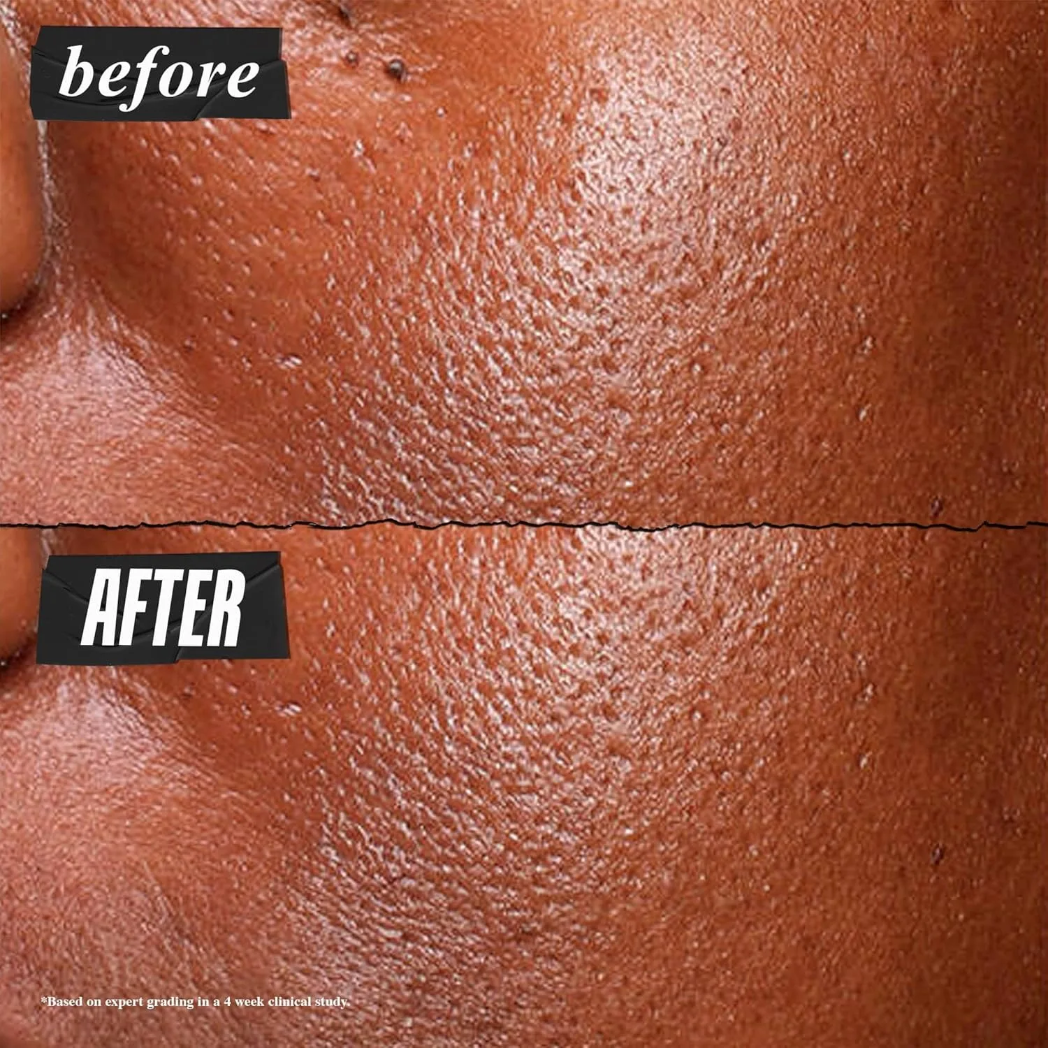 Сыворотка Kiehl's — Ultra Pure High-Potency . % ниацинамид для лица, концентрированная для жирной кожи, 30 мл — фото 3
