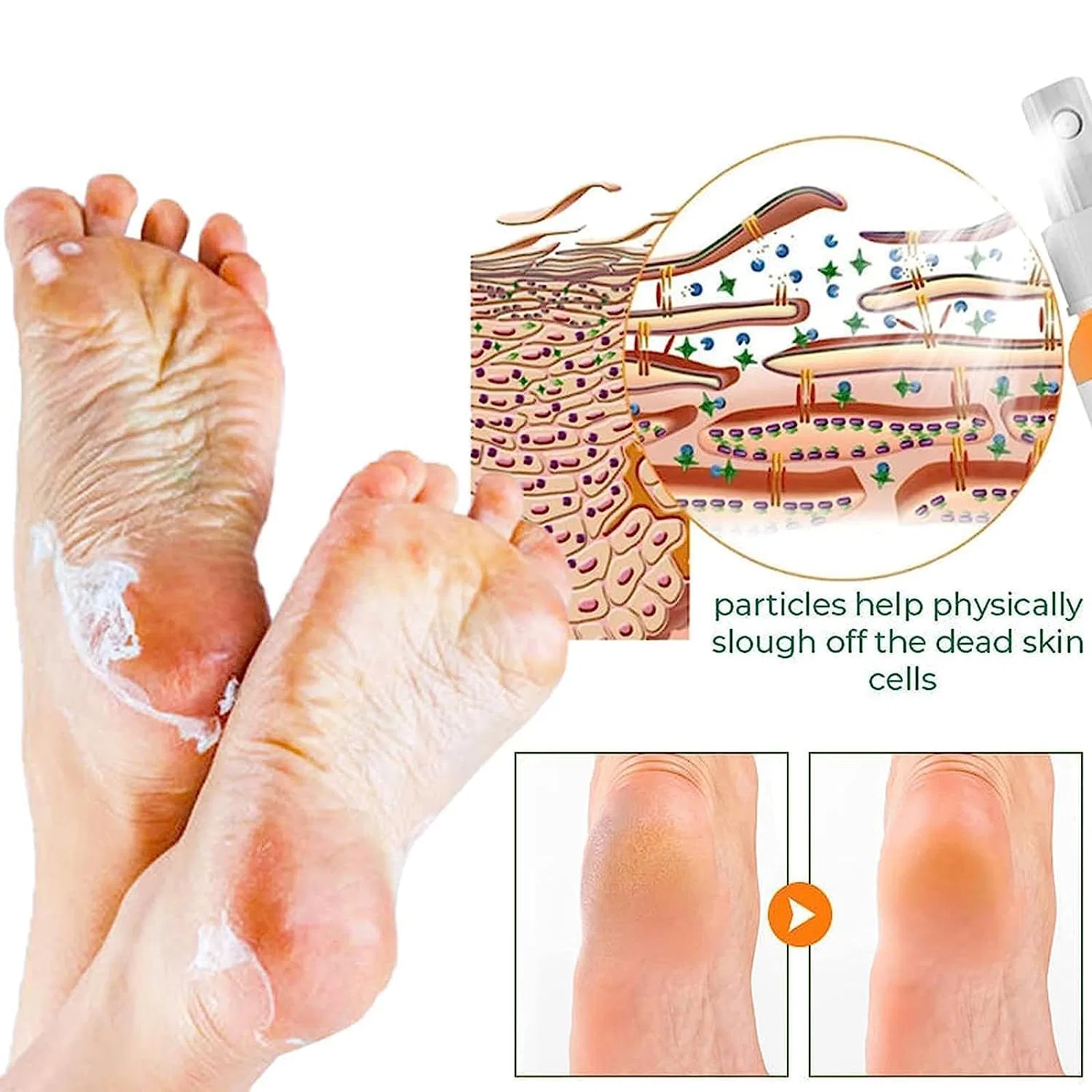 Спрей для удаления мозолей Gfouk Foot Callus Removal Spray, 30 мл ‎Flluouzh — фото 2