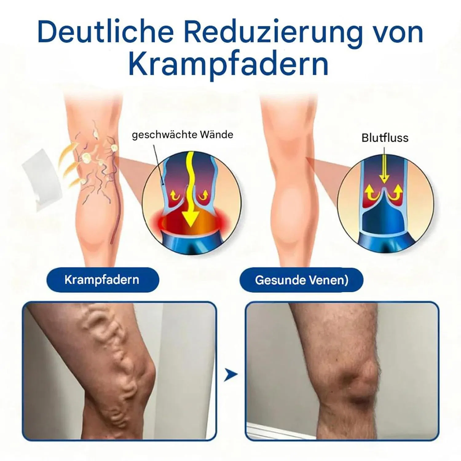 Микроигольный пластырь GFOUK Venous Relaxant для терапии вен ‎Hjjh, 2 — фото 3