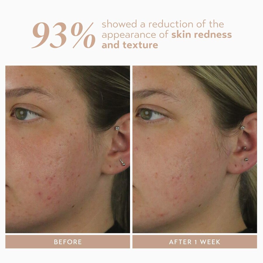 Сыворотка Shani Darden Skin Care — Восстанавливающая с % азелаиновым комплексом для борьбы с пигментными пятнами, 30 мл — фото 4