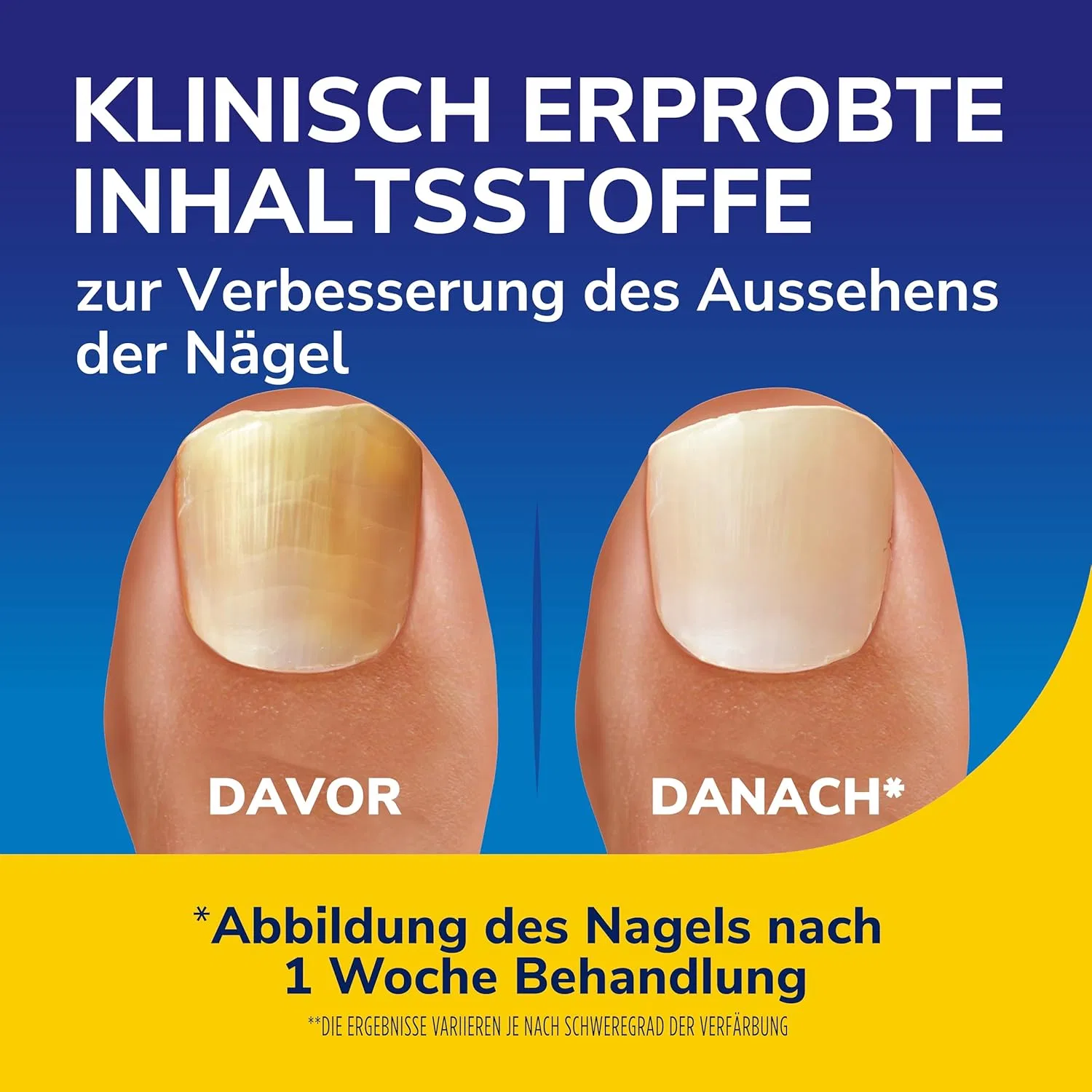 Сыворотка-ревитализатор для ногтей «Nail Revitaliser» 10 мл от Dr. Scholl's Dr. Scholl'S — фото 3