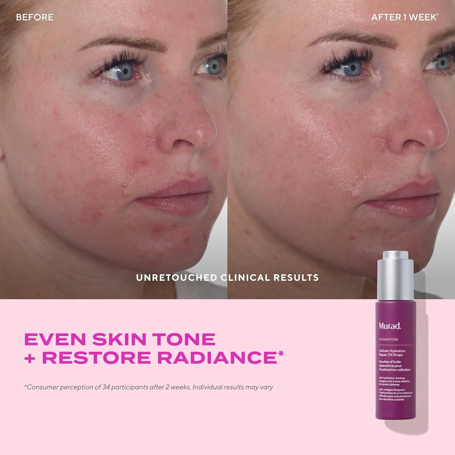 Сыворотка Murad — Увлажняющее Cellular Hydration Repair Oil Drops - для сухой, обезвоженной кожи, 28 г — фото 4