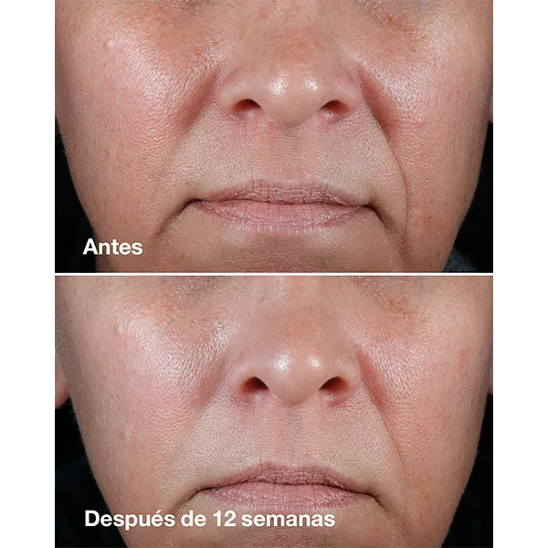 Сыворотка Clinique — Увлажняющий против морщин для сухой кожи Smart Clinical Repair Rich Cream, 50 мл — фото 3