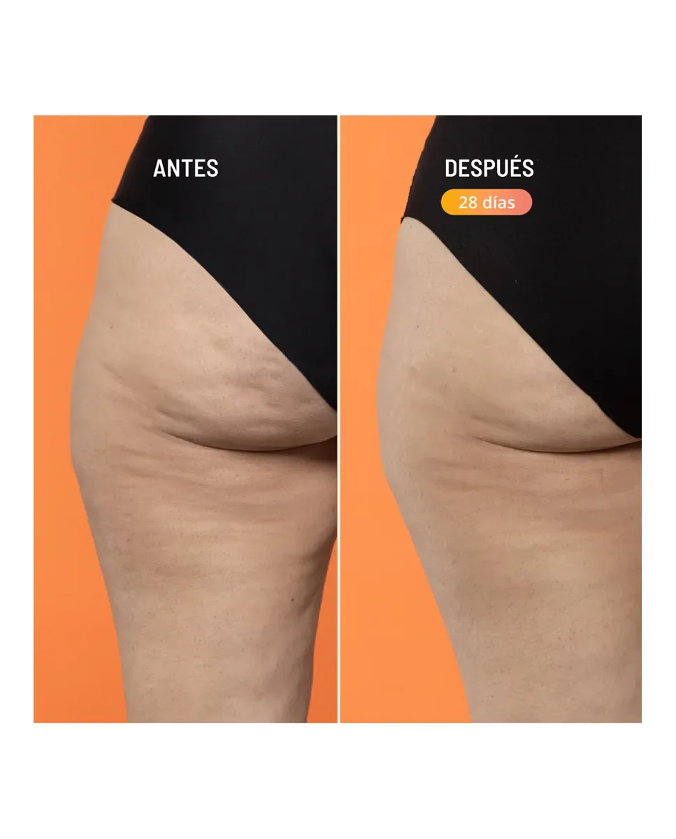 Антицеллюлитный крем Beta-Burner Sculpting Treatment 100 мл Freshly Cosmetics — фото 2