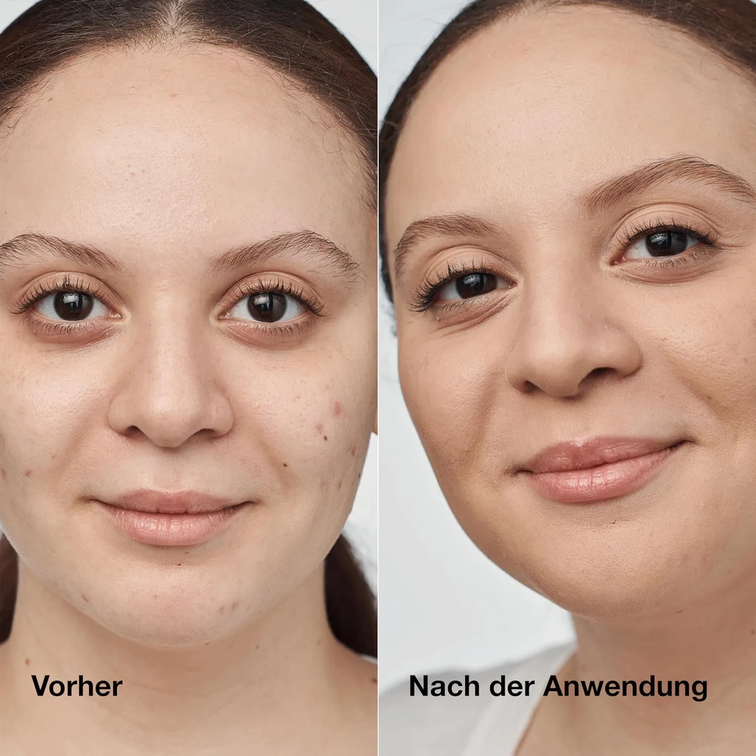 Тональная основа Even Better Clinical Serum Foundation SPF 20 от Clinique Clinique, Cn 52 Neutral — фото 3