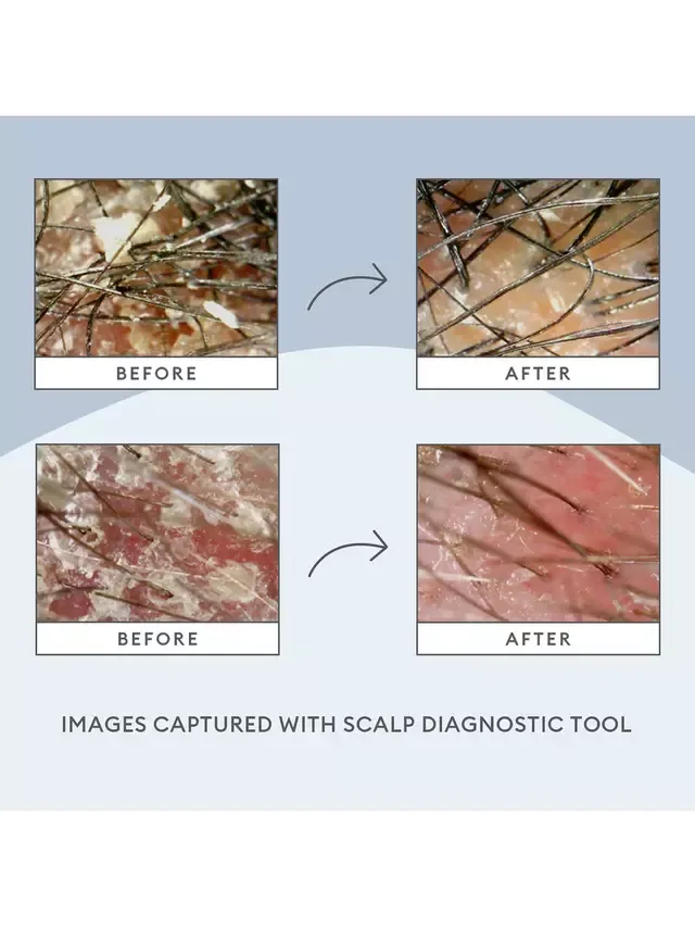 Отшелушивающий шампунь Scalp Revival с углем и кокосовым маслом, 236 мл Briogeo — фото 2