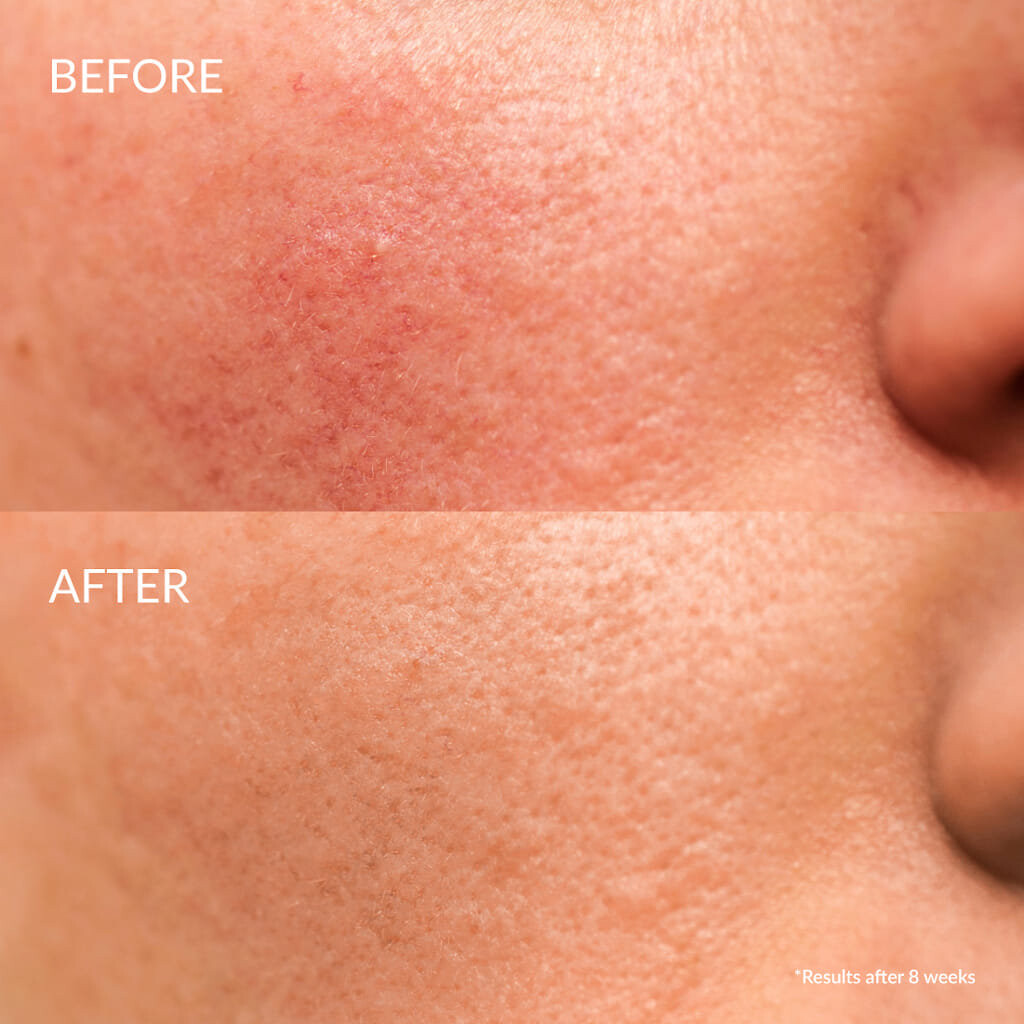Сыворотка — Ирен Шизен, Успокаивающая для лица – Keep Calm Soothing Serum, Inna Marka, 20 мл — фото 2