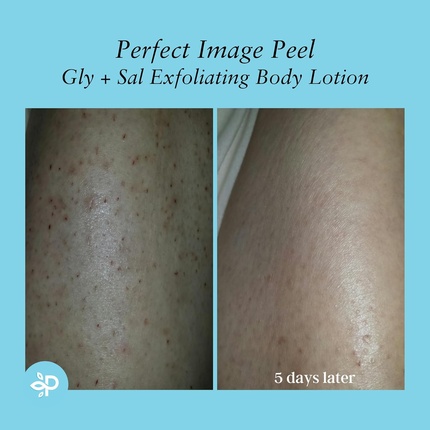 Лосьон для тела Gly 10% + Sal 2% Exfoliating Enhanced with Green Tea Papaya Bearberry Licorice Amino Complex — фото 2